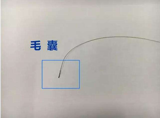 亲子鉴定