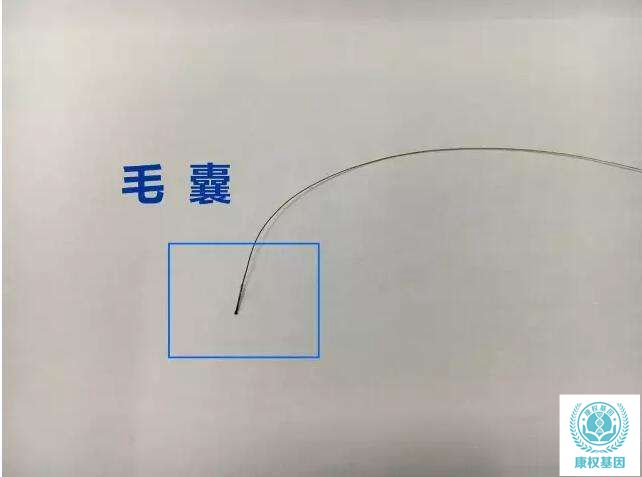惠州隐私亲子鉴定